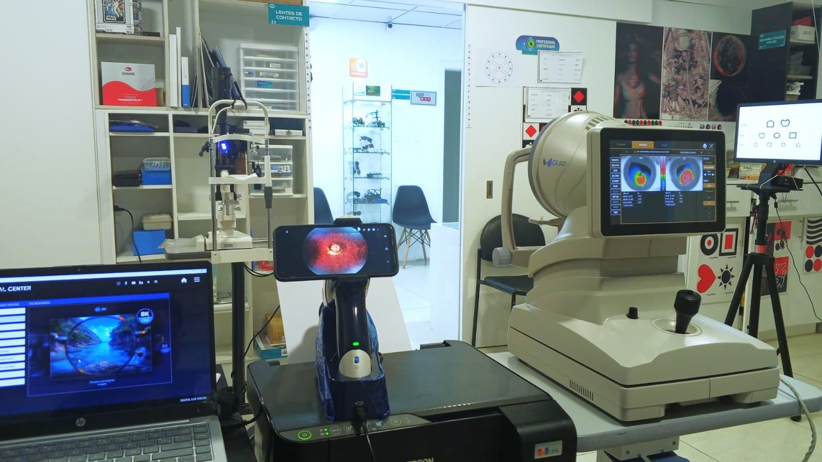 Consultorio óptico en Ibarra, Digital LuxVision, Hospital Universitario UTN